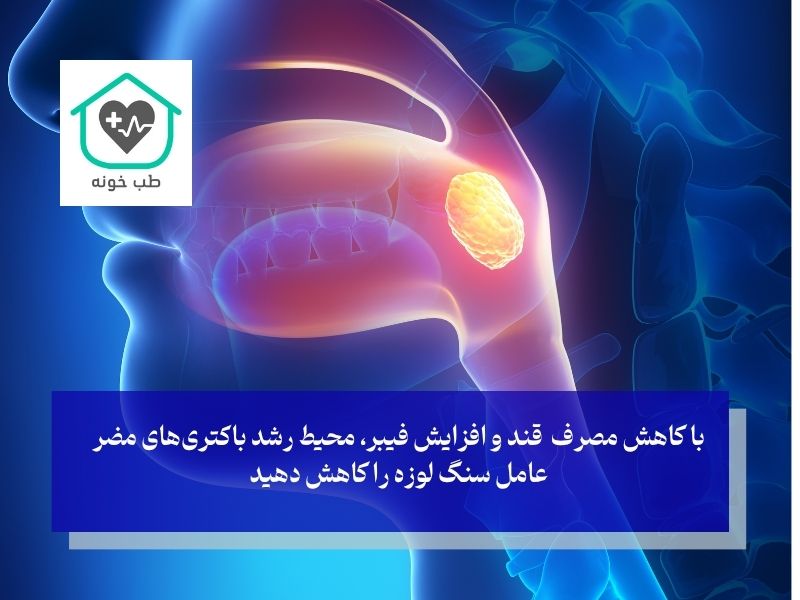 رژیم غذایی مخصوص بیماران مستعد سنگ لوزه