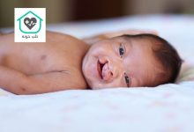 شکاف کام و لب چیست