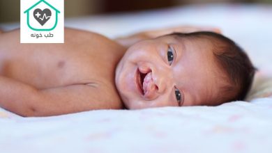 شکاف کام و لب چیست