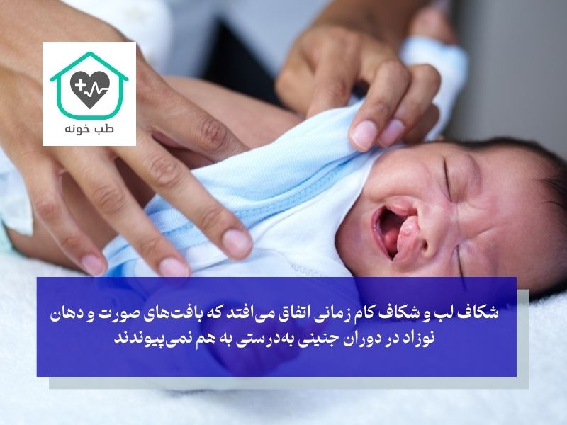 علت‌های شکاف کام و لب