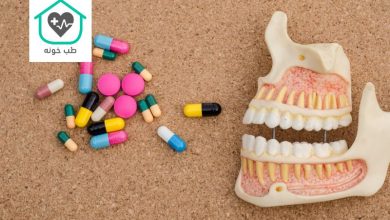 قرص برای درد فک