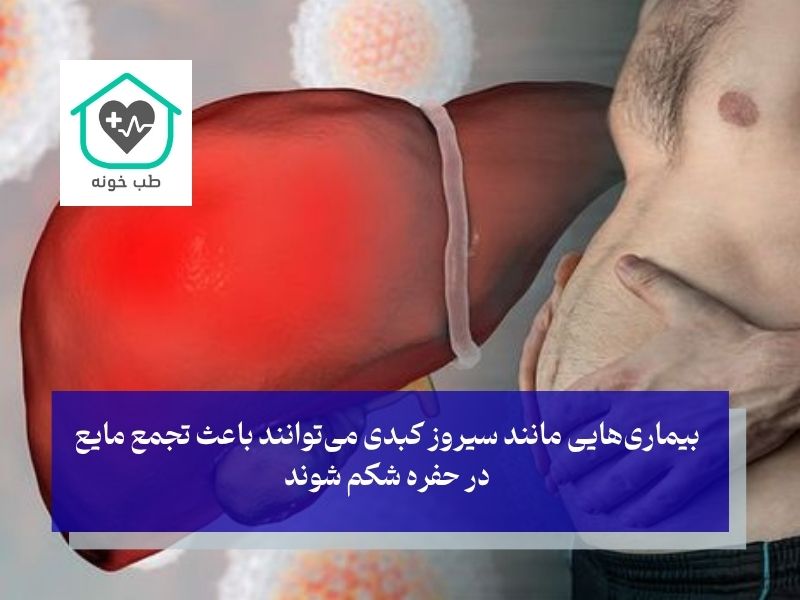 مشکلات کبدی و تورم شکم
