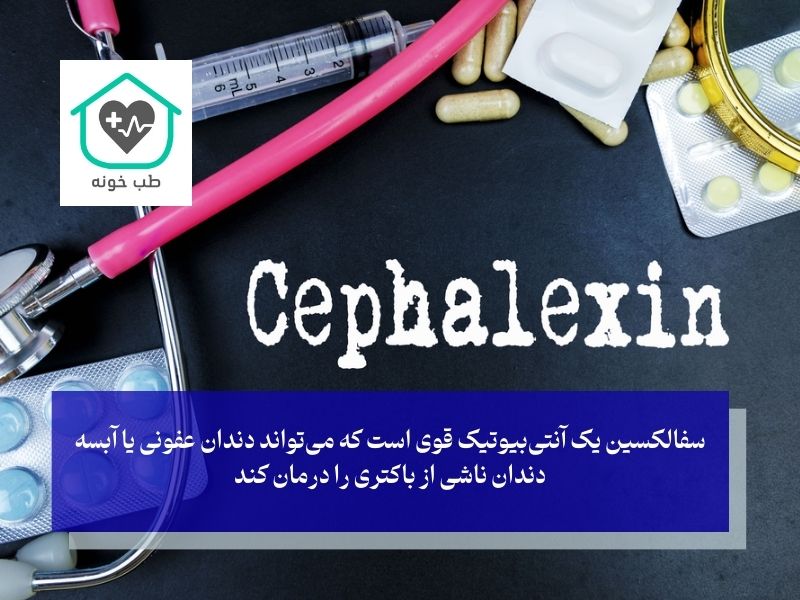 آیا سفالکسین می‌تواند عفونت دندان را درمان کند