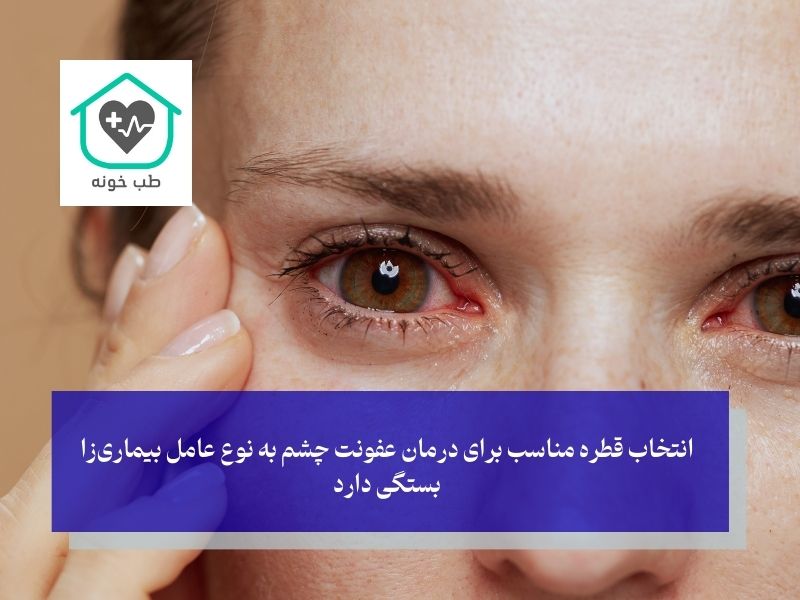 بهترین قطره برای عفونت چشم