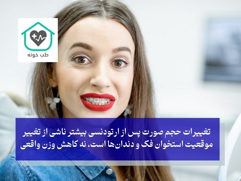 ایا ارتودنسی باعث لاغری صورت میشود
