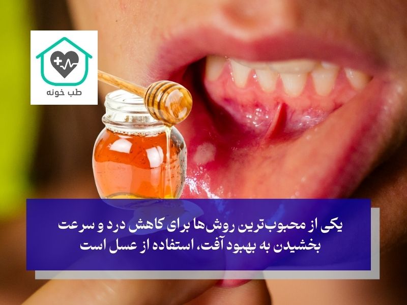 بهترین درمان خانگی آفت دهان