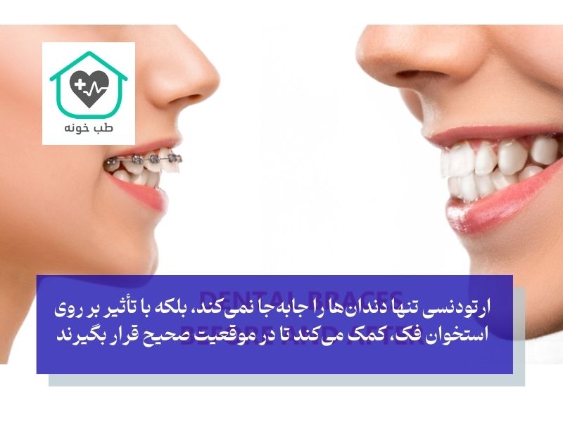 تاثیر ارتودنسی بر فک بالا و فک پایین