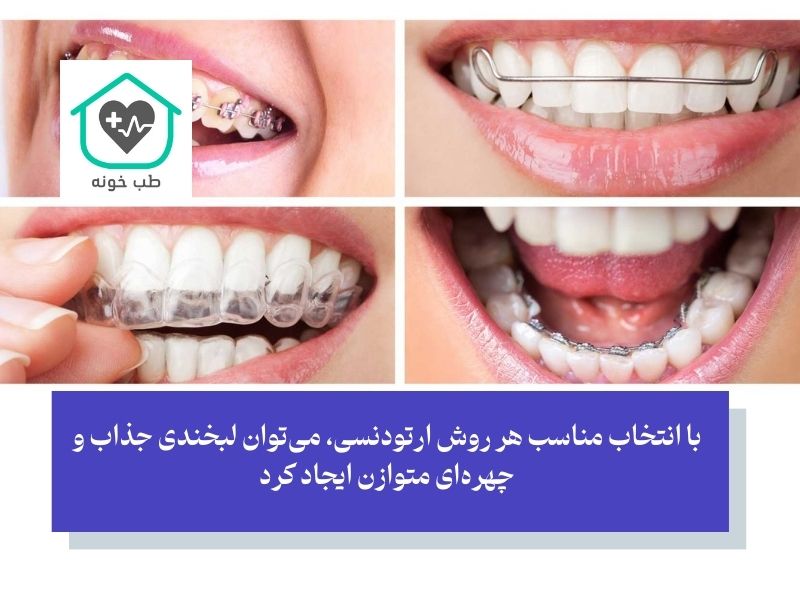 تاثیر ارتودنسی بر چهره و زیبایی صورت با روش‌های مختلف