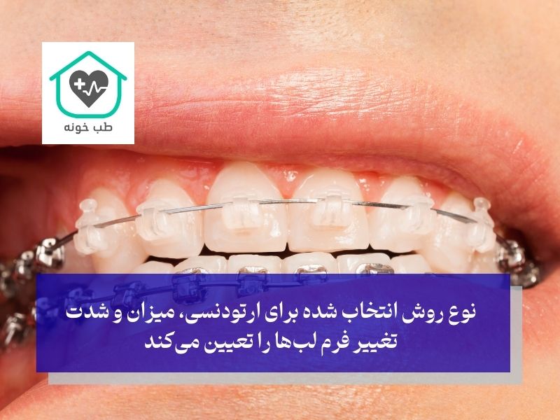 تاثیر نوع ارتودنسی در تغییر فرم لب بعد از ارتودنسی