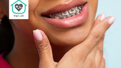 تغییر فرم لب بعد از ارتودنسی