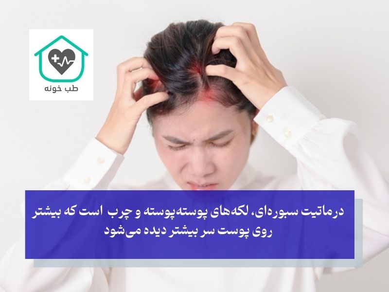 درماتیت سبوره‌ای