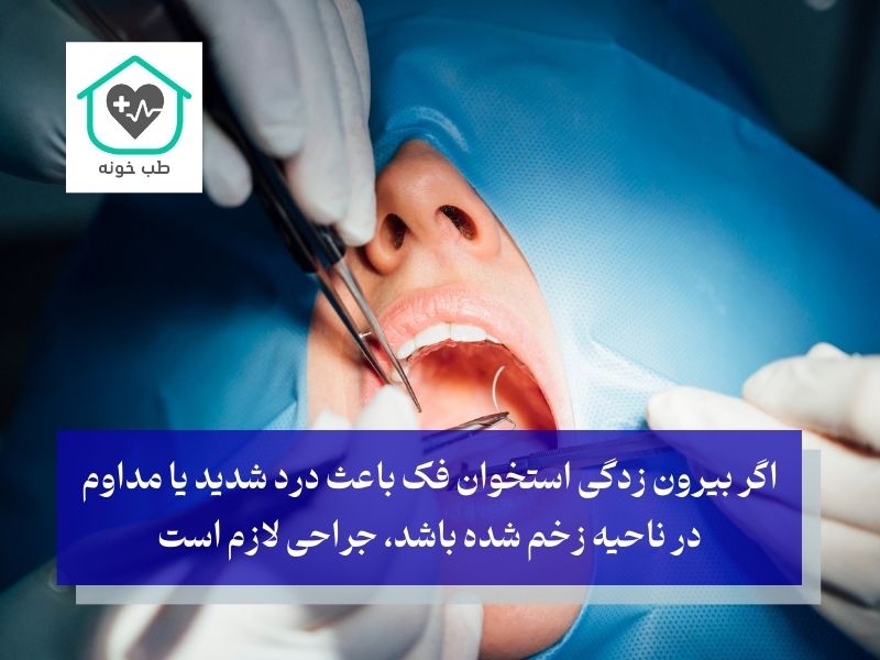 درمان بیرون زدگی استخوان فک بعد از کشیدن دندان