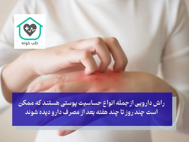 انواع لکه های حساسیت پوستی