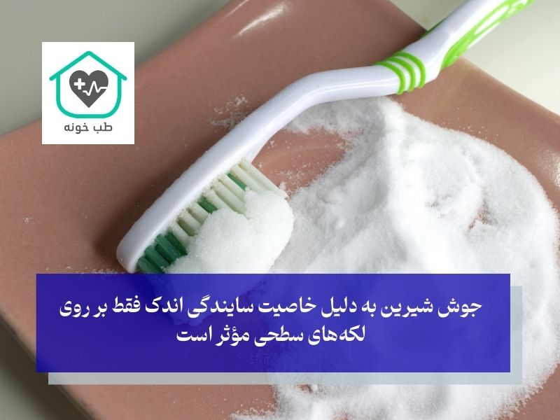 سفید کردن دندان با جوش شیرین با خاصیت سایندگی ملایم