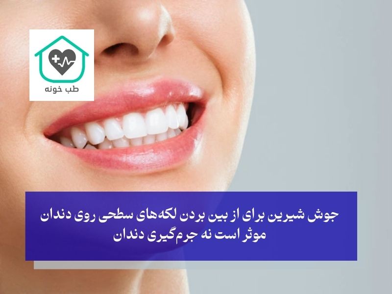 سفید کردن دندان با جوش شیرین موثر است نه جرمگیری
