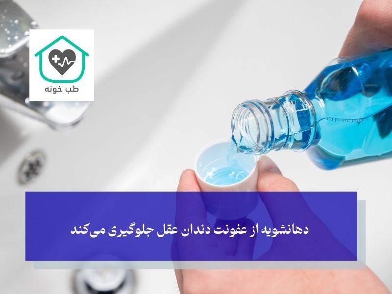 دهانشویه از عفونت دندان عقل جلوگیری می‌کند