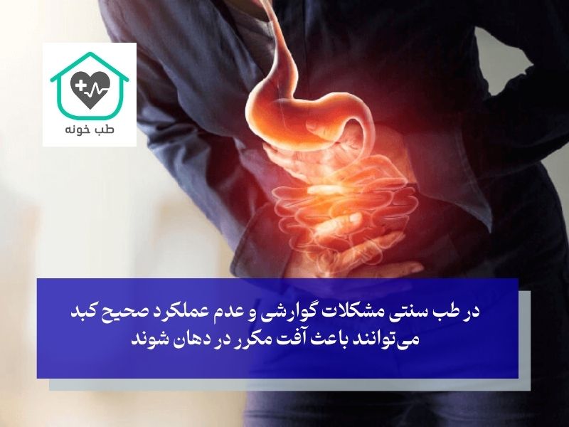 علت آفت مکرر دهان در طب سنتی