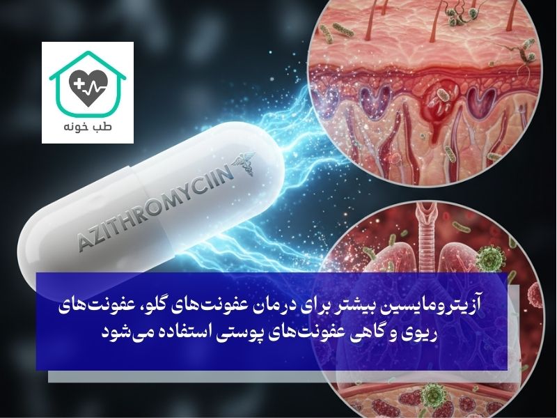 قرص چرک خشک کن قوی برای عفونت بدن آزیترومایسین
