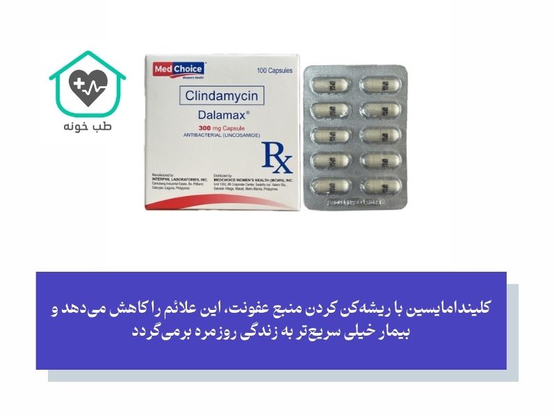 مزایای کلیندامایسین برای عفونت دندان
