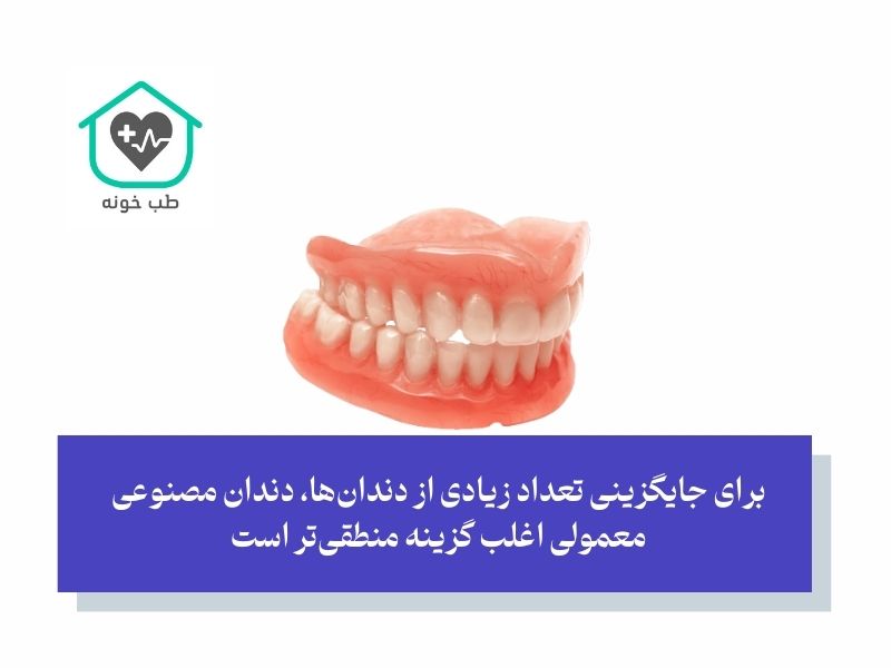 چه کسی بهترین کاندیدای دندان مصنوعی ژله ای است