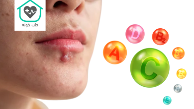 کمبود چه ویتامینی باعث تبخال میشود