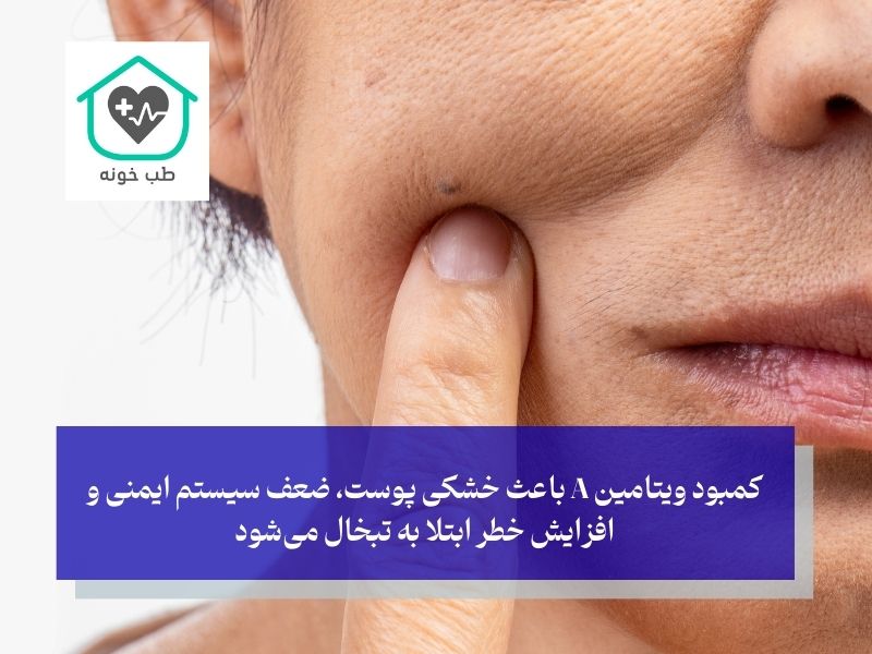 کمبود چه ویتامینی باعث تبخال میشود ویتامین ا