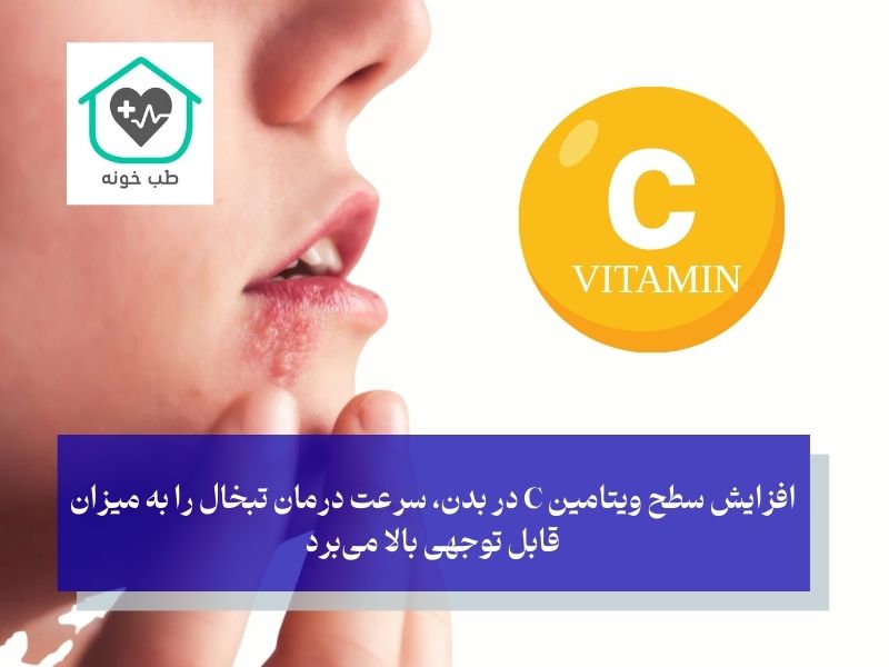کمبود چه ویتامینی باعث تبخال میشود ویتامین سی