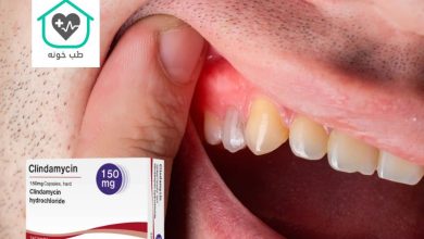 کپسول کلیندامایسین برای عفونت دندان