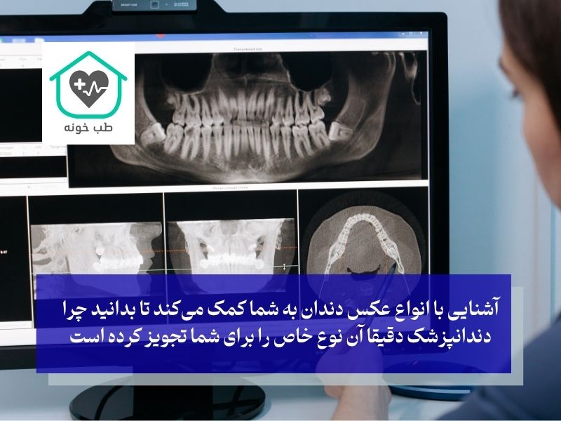 انواع عکس دندان؛ کدام عکس برای کدام مشکل تجویز می‌شود