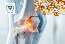 انواع قرص غضروف ساز