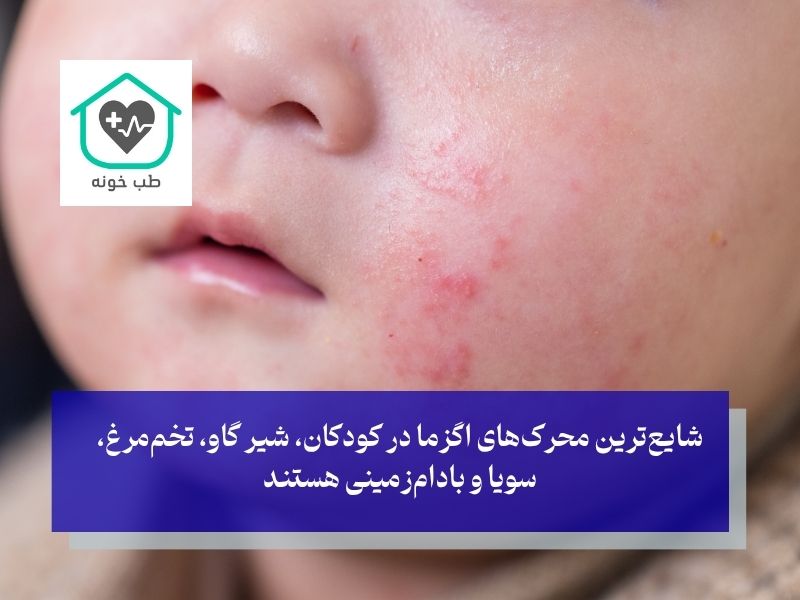 اگزما در کودکان و نوزادان؛ چه نکات تغذیه‌ای را باید رعایت کرد