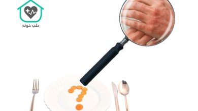 برای درمان اگزما چی بخوریم