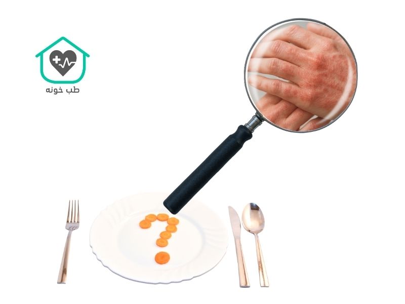 برای درمان اگزما چی بخوریم