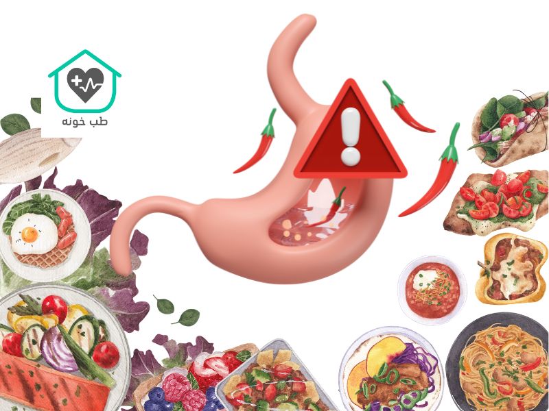 برای رفلاکس معده چه بخوریم