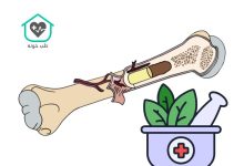 بهترین دارو برای جوش خوردن استخوان