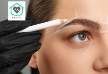 بهترین کلینیک کاشت ابرو در تهران