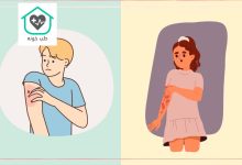 بیماری زونا واگیردار است