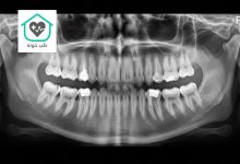 رادیولوژی دندانپزشکی