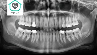 رادیولوژی دندانپزشکی