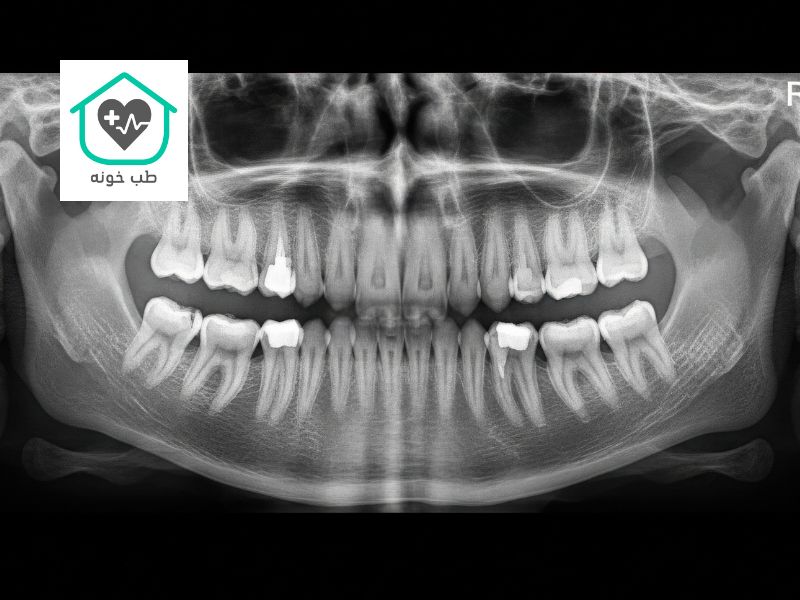 رادیولوژی دندانپزشکی