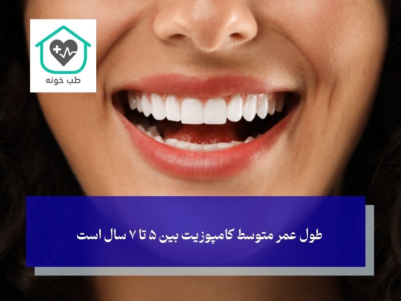 طول عمر کامپوزیت و ارتباط آن با پوسیدگی