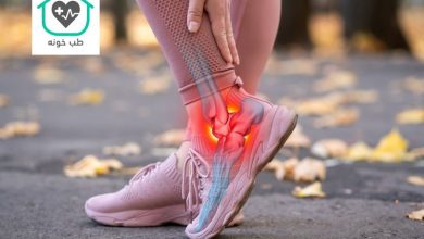 علت درد مچ پا هنگام راه رفتن