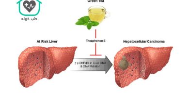مضرات چای سبز برای کبد