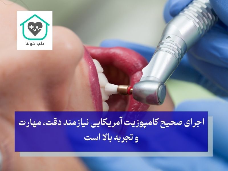 نکات قابل توجه کامپوزیت آمریکایی