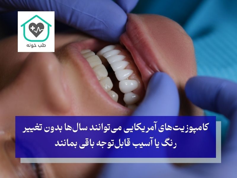 ویژگی‌های کامپوزیت آمریکایی