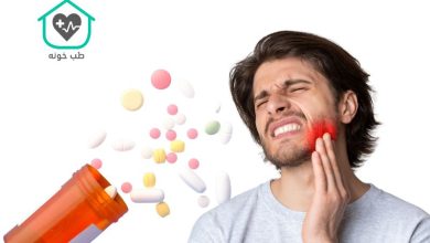 چرک خشک کن قوی برای عفونت لثه