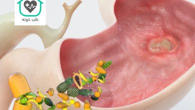 چه میوه هایی برای زخم معده مفید است