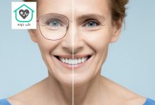 چگونه چشم ضعیف را قوی کنیم