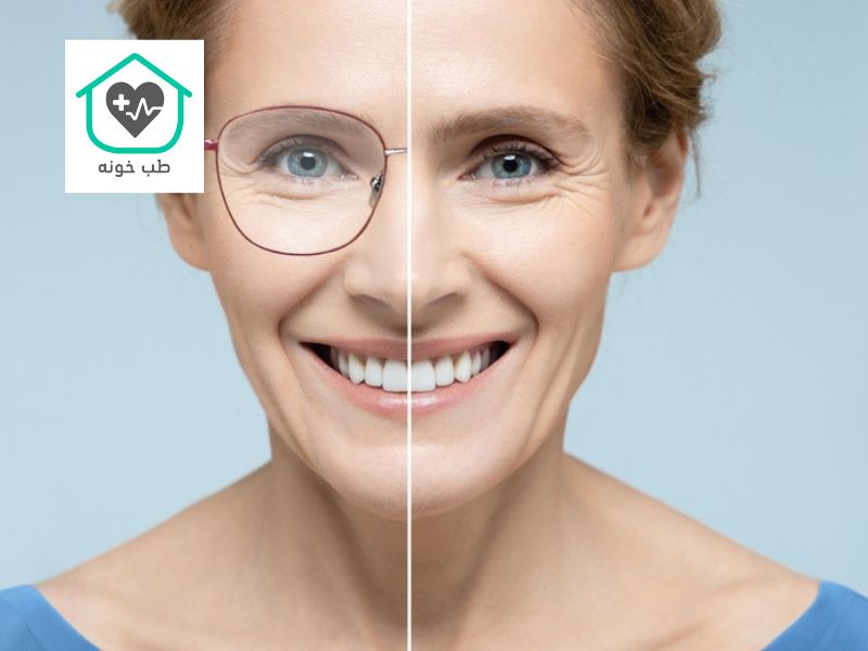 چگونه چشم ضعیف را قوی کنیم