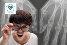 کلسیفیکاسیون چیست